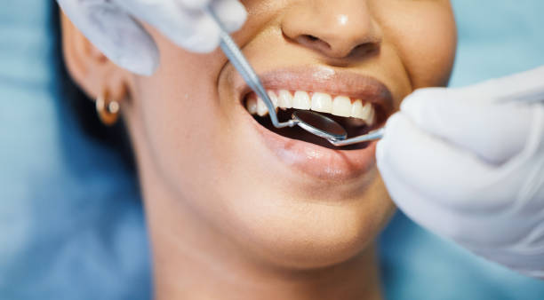 Best Dental Exams and Cleanings  in Martinsvle, IL